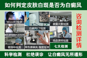 怎么确定自己的白斑是不是白癜风呢?