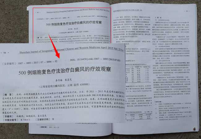 权威杂志《深圳中西医结合杂志》刊发“细胞复色疗法”论文