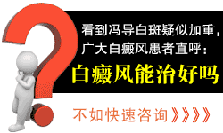 看到冯导白斑疑似加重,广大白癜风患者直呼:白癜风能治好吗?
