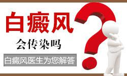 白癜风传染吗?